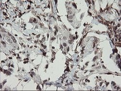 F13A1 Monoclonal Antibody (OTI6F5), TrueMAB , OriGene 100 &mu;L; Unconjugated:Antibodies,