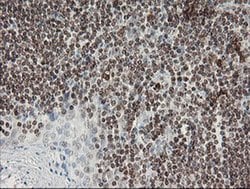 F13A1 Monoclonal Antibody (OTI6F5), TrueMAB , OriGene 100 &mu;L; Unconjugated:Antibodies,