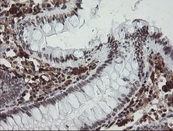 F13A1 Monoclonal Antibody (OTI6F5), TrueMAB , OriGene 100 &mu;L; Unconjugated:Antibodies,
