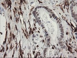 F13A1 Monoclonal Antibody (OTI6F5), TrueMAB , OriGene 100 &mu;L; Unconjugated:Antibodies,
