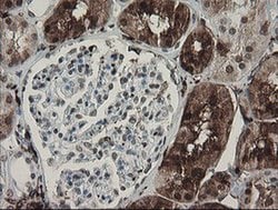 F13A1 Monoclonal Antibody (OTI6F5), TrueMAB , OriGene 100 &mu;L; Unconjugated:Antibodies,