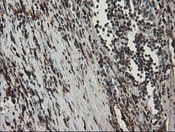 F13A1 Monoclonal Antibody (OTI6F5), TrueMAB , OriGene 100 &mu;L; Unconjugated:Antibodies,