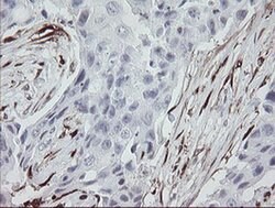 F13A1 Monoclonal Antibody (OTI3F1), TrueMAB , OriGene 100 &mu;L; Unconjugated:Antibodies,