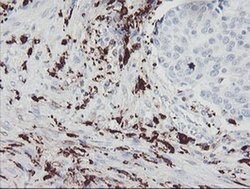 F13A1 Monoclonal Antibody (OTI3F1), TrueMAB , OriGene 100 &mu;L; Unconjugated:Antibodies,