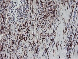 F13A1 Monoclonal Antibody (OTI3F1), TrueMAB , OriGene 100 &mu;L; Unconjugated:Antibodies,