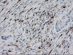 F13A1 Mouse anti-Human, Clone: OTI9E2, lyophilized, TrueMAB 100 &mu;g;