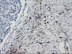 F13A1 Mouse anti-Human, Clone: OTI9E2, lyophilized, TrueMAB 100 &mu;g;