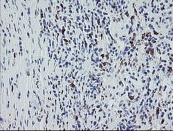 F13A1 Mouse anti-Human, Clone: OTI9E2, lyophilized, TrueMAB 100 &mu;g;