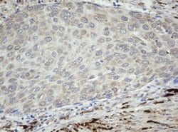 F13A1 Monoclonal Antibody (OTI3F8), TrueMAB , OriGene 100 &mu;L; Unconjugated:Antibodies,