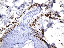 F13A1 Mouse anti-Human, Clone: UMAB243, liquid, UltraMAB 100 &mu;L; Unconjugated:Antibodies,