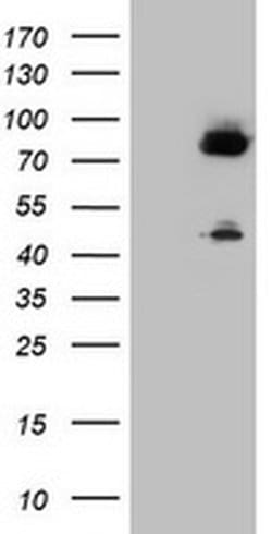 F13A1 Monoclonal Antibody (OTI4D2), TrueMAB , OriGene 100 &mu;L; Unconjugated:Antibodies,