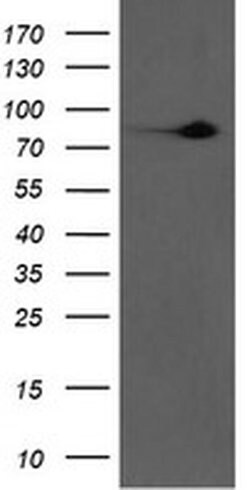 F13A1 Monoclonal Antibody (OTI6F5), TrueMAB , OriGene 100 &mu;L; Unconjugated:Antibodies,