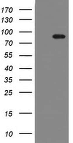 F13A1 Monoclonal Antibody (OTI3F1), TrueMAB , OriGene 100 &mu;L; Unconjugated:Antibodies,