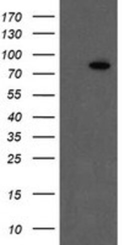 F13A1 Mouse anti-Human, Clone: OTI9E2, lyophilized, TrueMAB 100 &mu;g;