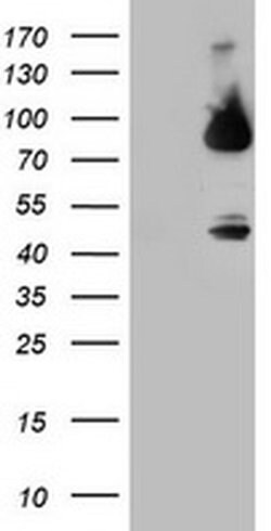 F13A1 Monoclonal Antibody (OTI3G12), TrueMAB , OriGene 100 &mu;L; Unconjugated:Antibodies,