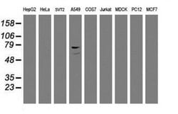 F13A1 Monoclonal Antibody (OTI3G12), TrueMAB , OriGene 100 &mu;L; Unconjugated:Antibodies,