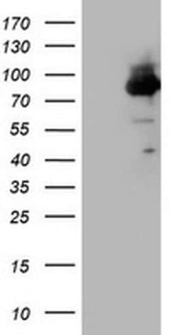 F13A1 Monoclonal Antibody (OTI8E2), TrueMAB , OriGene 100 &mu;L; Unconjugated:Antibodies,