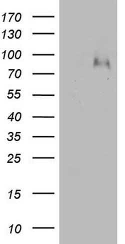F13B Monoclonal Antibody (OTI1A3), TrueMAB , OriGene:Antibodies:Primary
