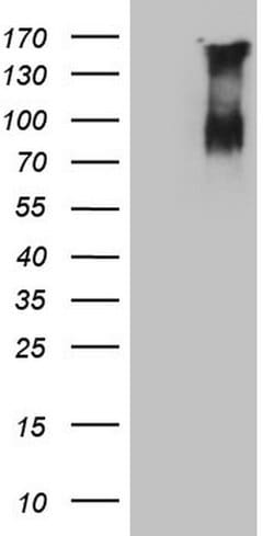 F13B Monoclonal Antibody (OTI2D4), TrueMAB , OriGene:Antibodies:Primary