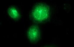 FA2H Monoclonal Antibody (OTI1C5), TrueMAB , OriGene 100 &mu;L; Unconjugated:Antibodies,