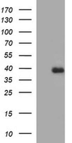 FA2H Monoclonal Antibody (OTI1C5), TrueMAB , OriGene 100 &mu;L; Unconjugated:Antibodies,