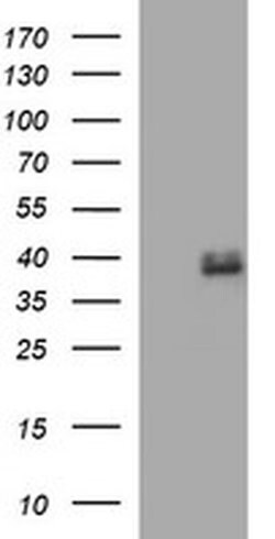 FA2H Monoclonal Antibody (OTI1B5), TrueMAB , OriGene 100 &mu;L; Unconjugated:Antibodies,