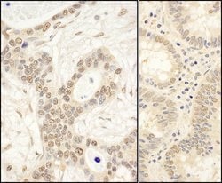 FAF1 Rabbit anti-Human, Mouse, Polyclonal, Bethyl Laboratories 100 &mu;L;