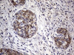 FAF1 Monoclonal Antibody (OTI11G10), TrueMAB , OriGene 100 &mu;L; Unconjugated:Antibodies,