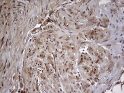 FAF1 Mouse anti-Human, Clone: OTI10D1, liquid, TrueMAB 100 &mu;L; Unconjugated:Antibodies,