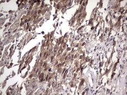 FAF1 Monoclonal Antibody (OTI2F9), TrueMAB , OriGene 100 &mu;L; Unconjugated:Antibodies,