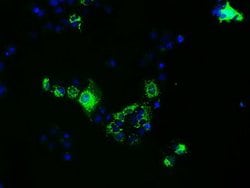 FAHD2A Mouse anti-Human, Clone: OTI5D4, lyophilized, TrueMAB 100 &mu;g;