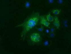 FAHD2A Mouse anti-Human, Clone: OTI9G1, lyophilized, TrueMAB 100 &mu;g;
