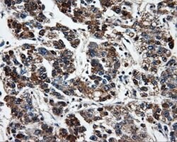 FAHD2A Monoclonal Antibody (OTI6D9), TrueMAB , OriGene 30 &mu;L; Unconjugated:Antibodies,