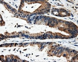 FAHD2A Mouse anti-Human, Clone: OTI9D4, lyophilized, TrueMAB 100 &mu;g;