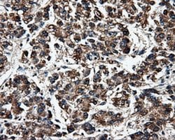 FAHD2A Monoclonal Antibody (OTI9D4), TrueMAB , OriGene 30 &mu;L; Unconjugated:Antibodies,