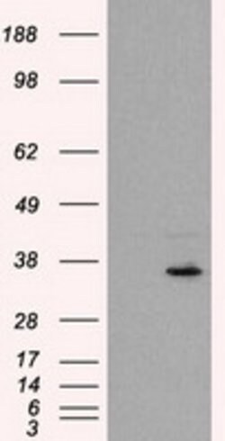 FAHD2A Mouse anti-Human, Clone: OTI5D4, lyophilized, TrueMAB 100 &mu;g;
