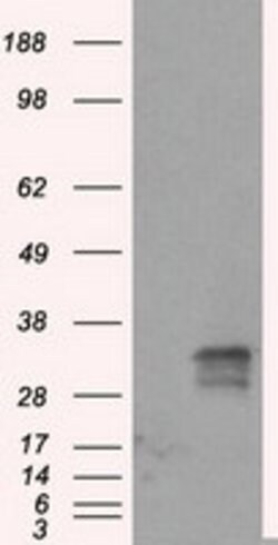 FAHD2A Mouse anti-Human, Clone: OTI5D5, lyophilized, TrueMAB 100 &mu;g;