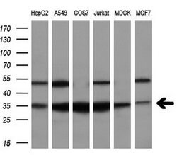 FAHD2A Mouse anti-Human, Clone: OTI9D4, lyophilized, TrueMAB 100 &mu;g;