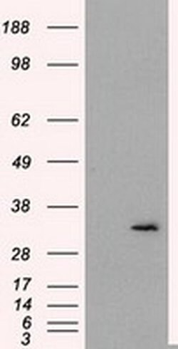 FAHD2A Monoclonal Antibody (OTI5A7), TrueMAB , OriGene 100 &mu;L; Unconjugated:Antibodies,