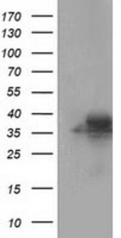FAHD2A Mouse anti-Human, Clone: OTI7B7, lyophilized, TrueMAB 100 &mu;g;