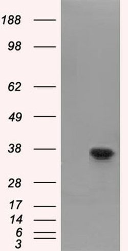 FAHD2A Monoclonal Antibody (OTI9B5), TrueMAB , OriGene 100 &mu;L; Unconjugated:Antibodies,