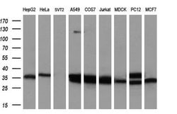 FAHD2A Monoclonal Antibody (OTI9B5), TrueMAB , OriGene 100 &mu;L; Unconjugated:Antibodies,