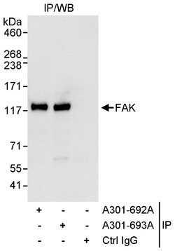 FAK Rabbit anti-Human, Polyclonal, Bethyl Laboratories 100 &mu;l; Unlabeled:Antibodies,