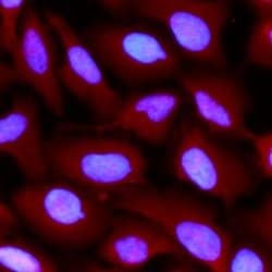 Invitrogen FAK Monoclonal Antibody (ZF002), Alexa Fluor 647 50 &mu;g; Alexa