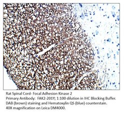 FAK2 Chicken anti-Human, Mouse, Rat, Polyclonal, FabGennix 200 &mu;L; Unconjugated:Antibodies,