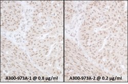 FALZ/BPTF Rabbit anti-Human, Polyclonal, Bethyl Laboratories 100 &mu;L;