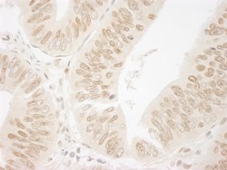FALZ/BPTF Polyclonal Antibody, Bethyl Laboratories 10 &mu;L; Unconjugated:Antibodies,