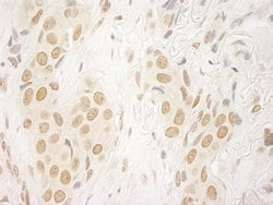 FALZ/BPTF Polyclonal Antibody, Bethyl Laboratories:Antibodies:Primary Antibodies