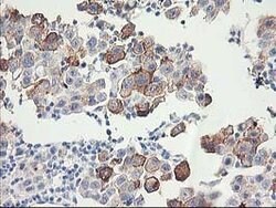 FAM119A Mouse anti-Human, Clone: OTI2G7, lyophilized, TrueMAB 100 &mu;g;