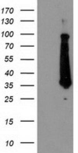 FAM119A Mouse anti-Human, Clone: OTI2G7, lyophilized, TrueMAB 100 &mu;g;